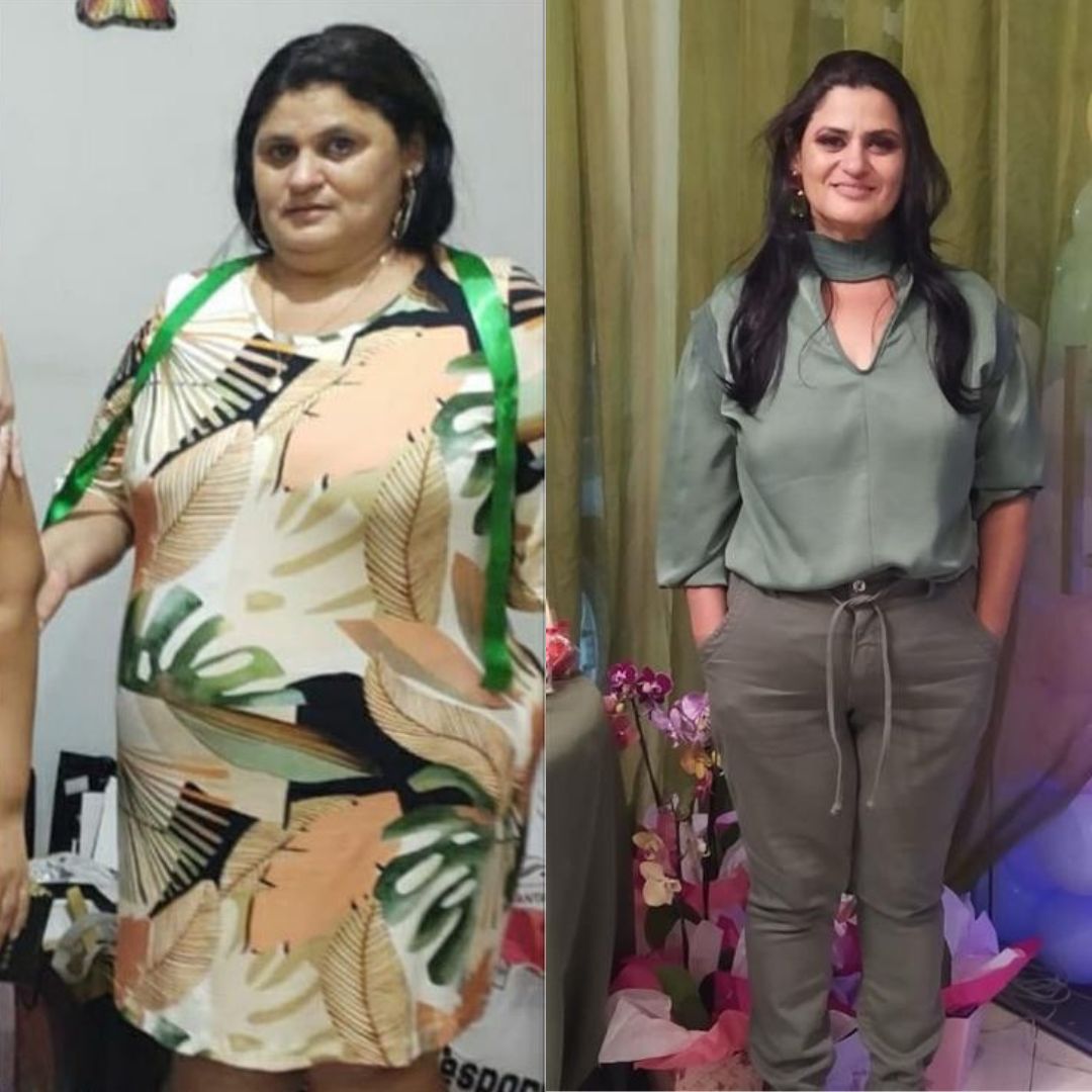 Transformação Antes e Depois 3